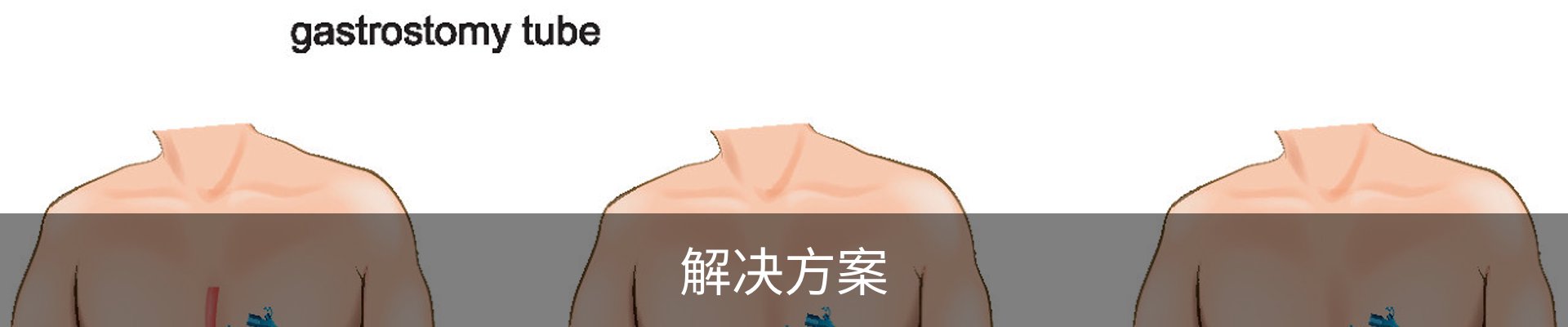 解决方案